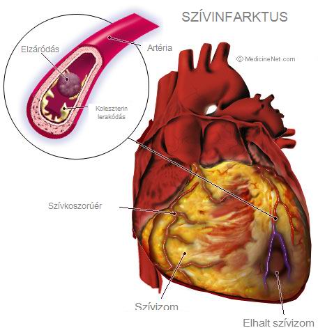 artéria egészség szív természetes